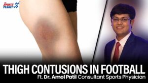 Thigh Contusions