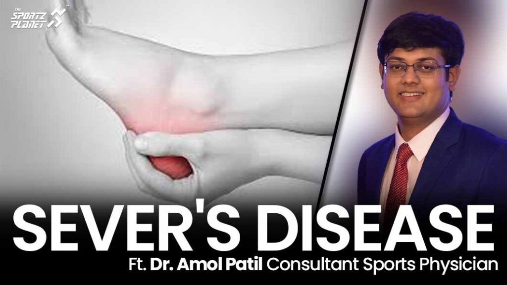Sever's Disease